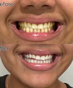 Fivfivgo™ Brilliance Soda Whitening Zahnpasta