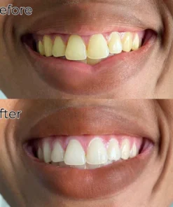 Fivfivgo™ Brilliance Soda Whitening Zahnpasta