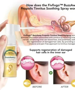 Fivfivgo™ BuzzAway Propolis Tinnitus Beruhigungsspray