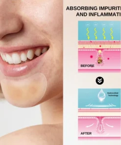 Fivfivgo™ Hydrogel-Aknepflastera