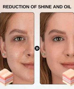 Fivfivgo™ Hydrogel-Aknepflastera