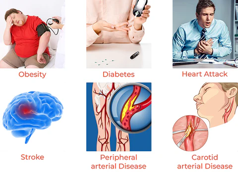 Fivfivgo™ Hyperlipidemia Cholesterol Balancing Belly Patch
