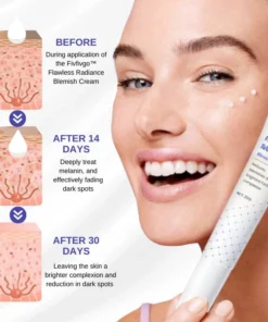 Fivfivgo™ Makellose strahlende Hautunreinheiten-Creme