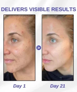 Fivfivgo™ Makellose strahlende Hautunreinheiten-Creme