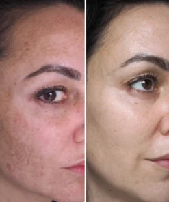 Fivfivgo™ Makellose strahlende Hautunreinheiten-Creme