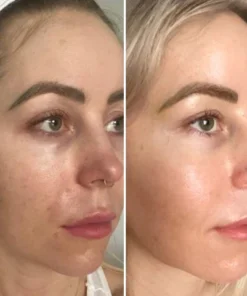 Fivfivgo™ Makellose strahlende Hautunreinheiten-Creme