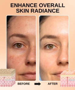 Fivfivgo™ Melanine Gesicht Korrigierendes ätherisches Öl