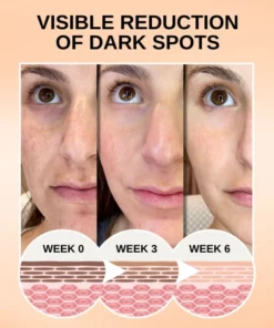 Fivfivgo™ Melanine Gesicht Korrigierendes ätherisches Öl