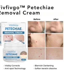 Fivfivgo™ Petechien Entfernungscreme