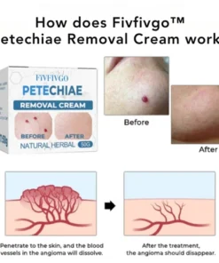 Fivfivgo™ Petechien Entfernungscreme