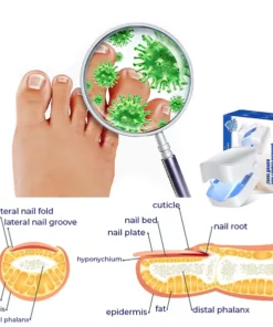 Fivfivgo™ Revolutionäres hocheffizientes Lichttherapiegerät für Zehennagelkrankheiten