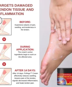 Fivfivgo™ Sehnen-Xanthomata Beruhigende Creme