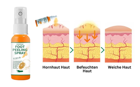 Fivfivgo™ Spray zur Entfernung von Fußschwielen
