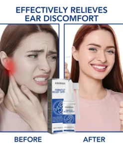 Fivfivgo™ Tinnitus-Linderungsspray