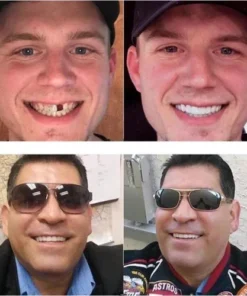 Fivfivgo™ Verstelbare Klikprothese