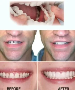 Fivfivgo™ Verstelbare Klikprothese