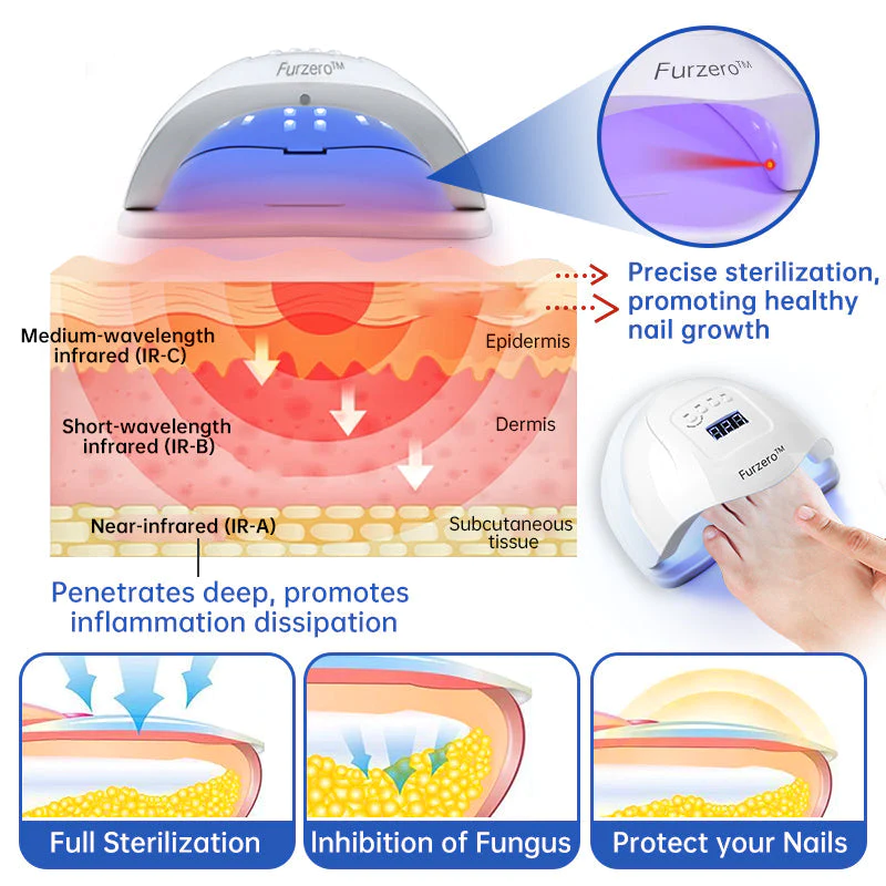 Furzero™ PureNail Fungus Laser Therapy Device Max