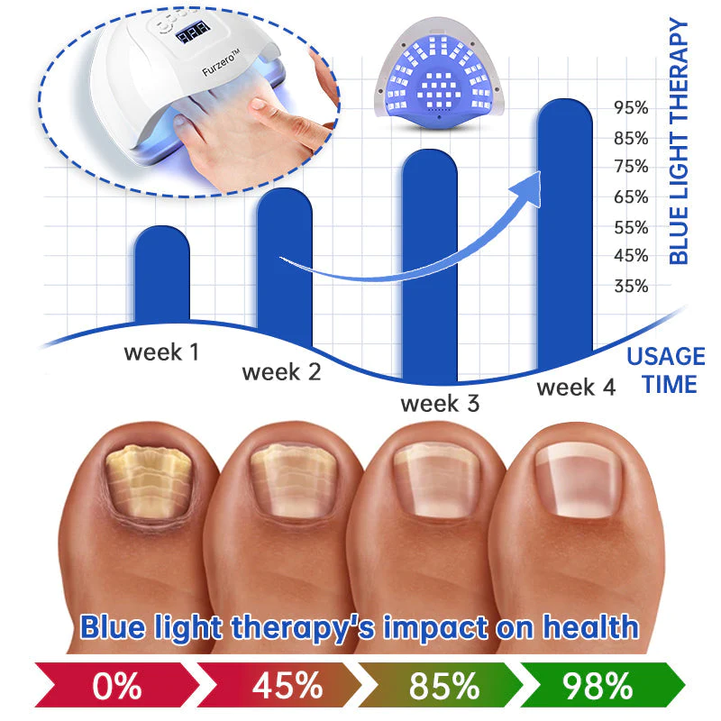 Furzero™ PureNail Fungus Laser Therapy Device Max