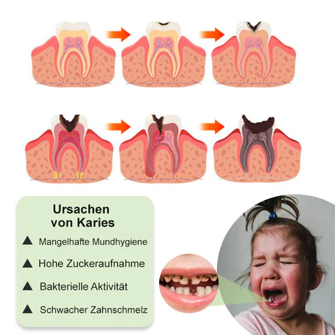 Furzero™ 100% Pflanzlicher Extrakt Mundpflegekonzentrat