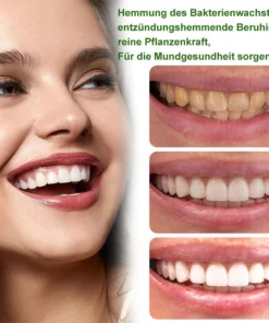 Furzero™ 100% Pflanzlicher Extrakt Mundpflegekonzentrat