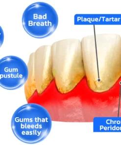 Furzero™ Propolis Oral Instant Treatment Spray