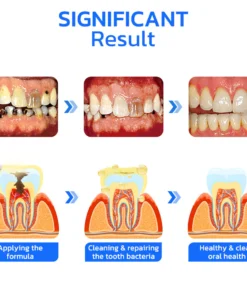 Furzero™ Propolis Oral Instant Treatment Spray