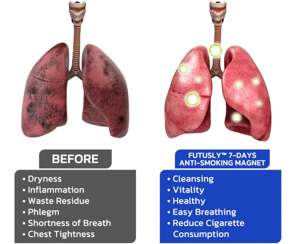 Futusly™ 7-Days Anti-Smoking Magnet