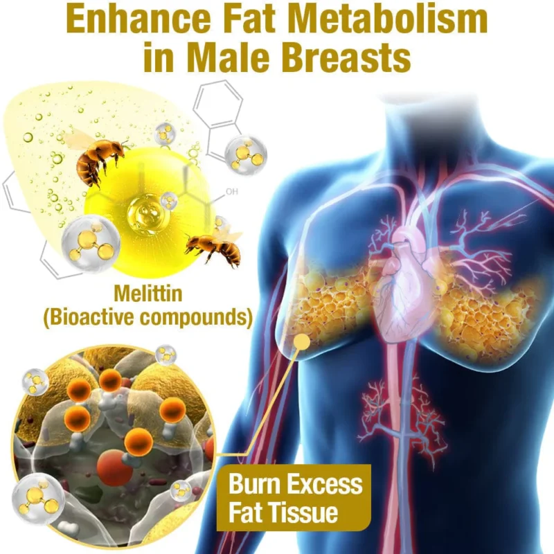 زيت التدفئة GFOUK™ MenTherm Bee Venom Gynecomastia