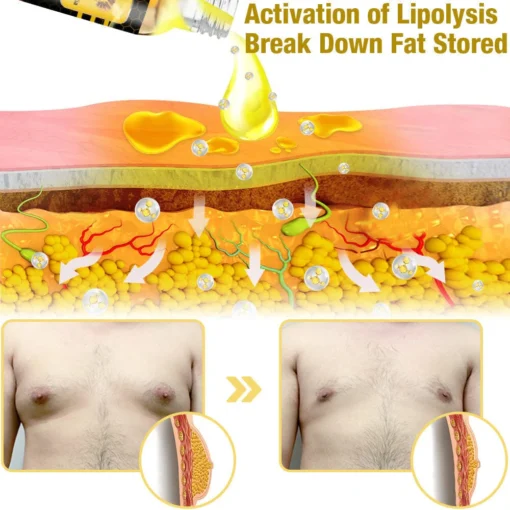 زيت التدفئة GFOUK™ MenTherm Bee Venom Gynecomastia - الصورة 3