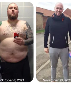 GFOUK™ Bee Venom Heat Sculpt Anti-Schwellung Crème