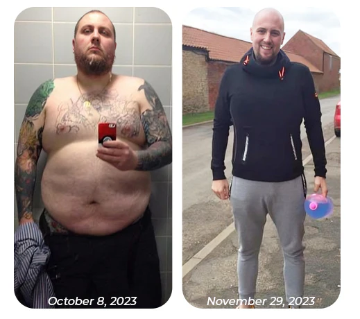 GFOUK™ Bee Venom Heat Sculpt Anti-Schwellung Crème