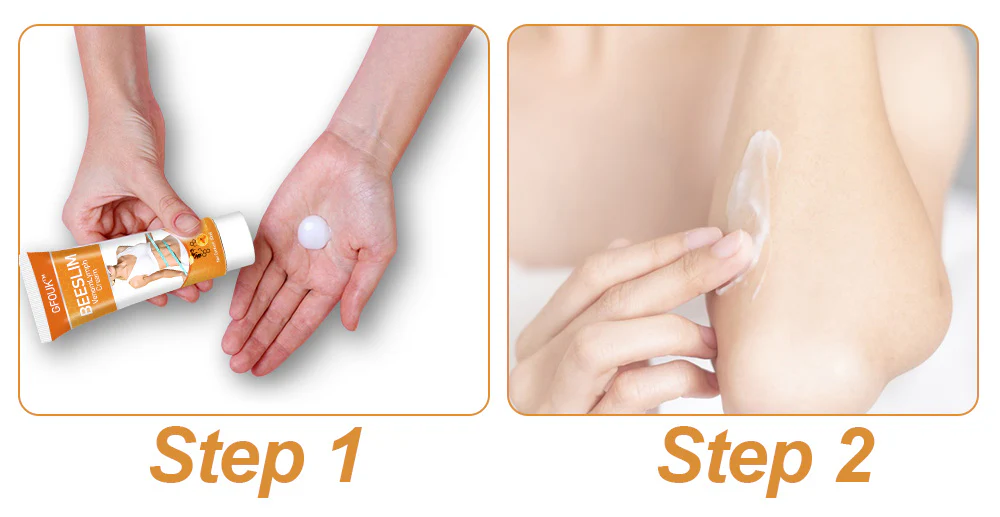 GFOUK™ BeeSlim VenomLymph Cream