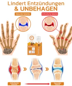 GFOUK™ Bienengift Gelenk- und Knochentherapie Spray