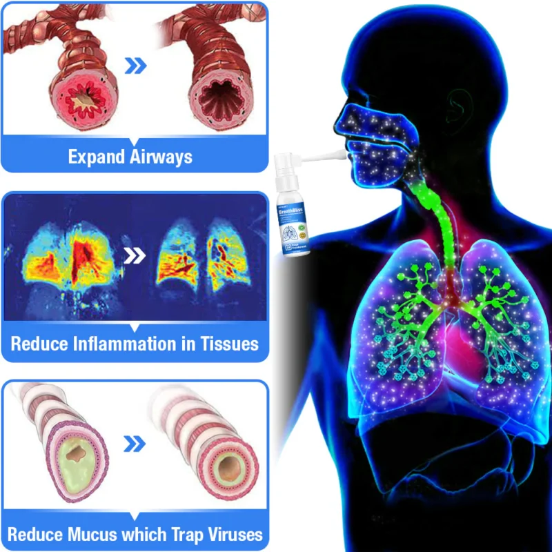 GFOUK™ BreathBliss Respiratory Cleansing Herbal Spray