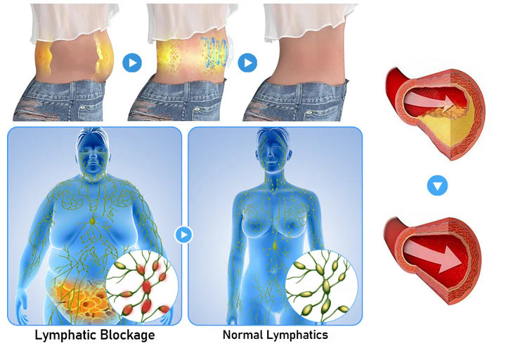 GFOUK™ ChuanSlim Patch