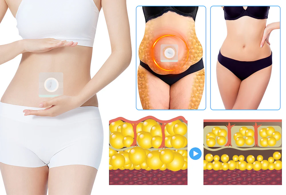 GFOUK™ ChuanSlim Patch