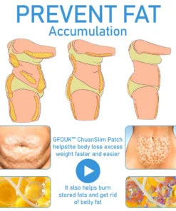 GFOUK™ ChuanSlim Patch