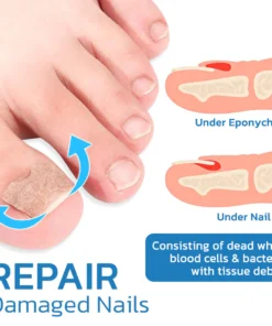GFOUK™ German ToenailHeal Paronychia Relief Patch