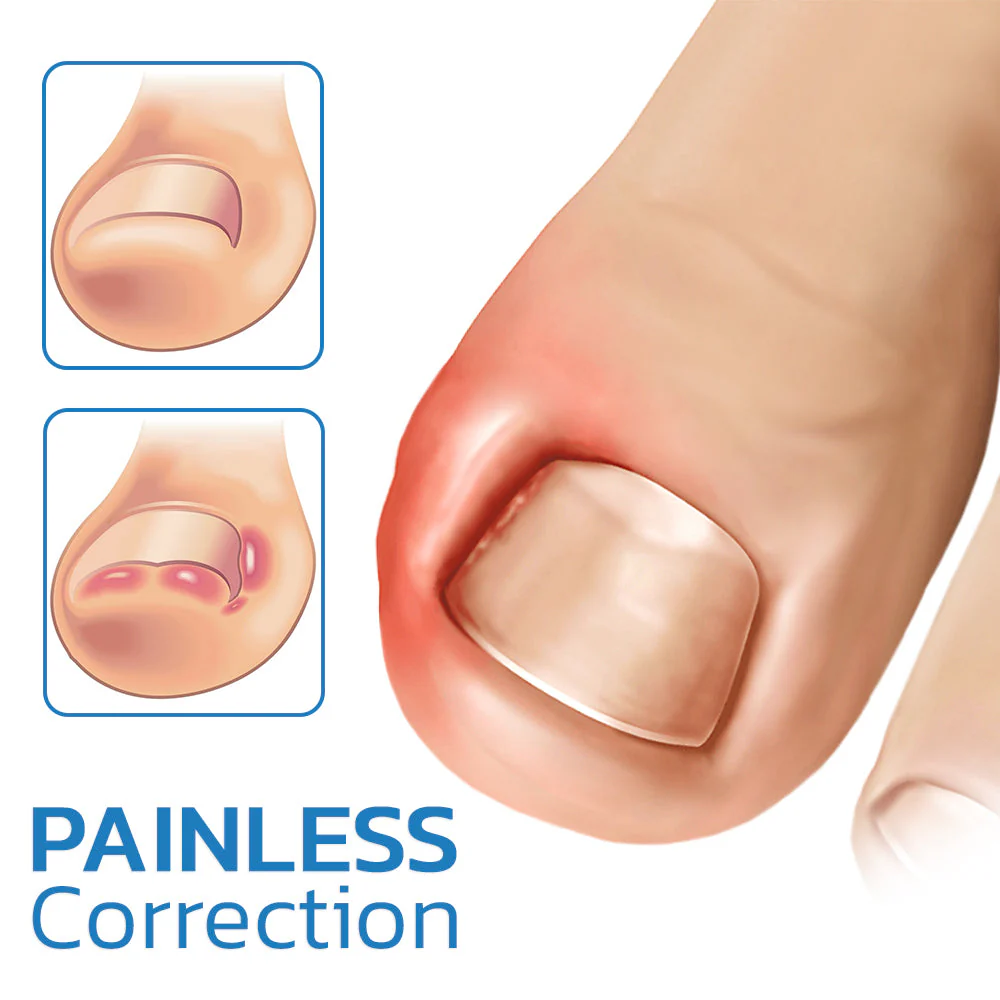 GFOUK™ German ToenailHeal Paronychia Relief Patch