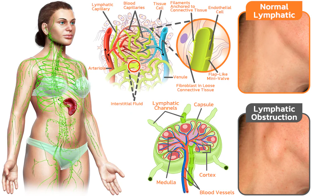 GFOUK™ LymFatTake Orange Blossom Slender Patch