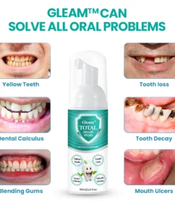 Gleam™ TOTAL Mouth Wash - Solve all Oral Problems