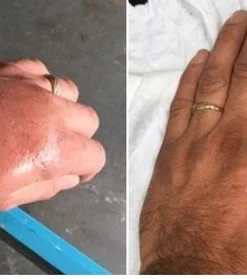 GoutAid™ Instant Relieving Spray