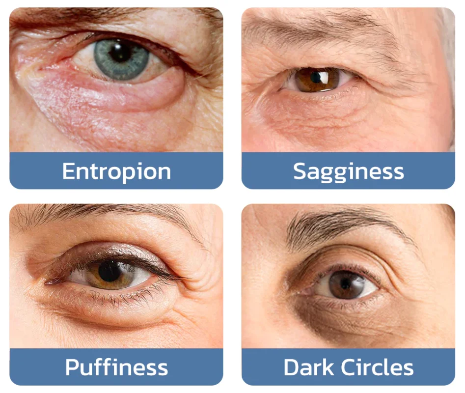 HIMEYE™ PEPTIDE Begietako sueroa