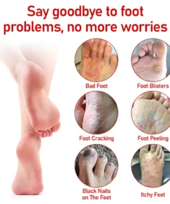 HerbalCare Medical Nail Fungus Foot Spray