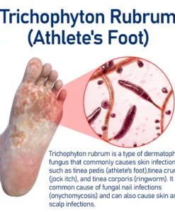 HerbalCare Medical Nail Fungus Foot Spray