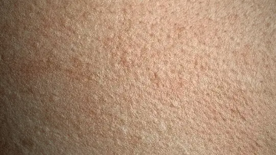 مصل الوجه Hyalu B5 النقي المضاد للشيخوخة