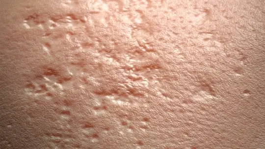 مصل الوجه Hyalu B5 النقي المضاد للشيخوخة