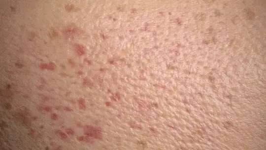 مصل الوجه Hyalu B5 النقي المضاد للشيخوخة