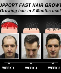 KISSHI™ LaserPRO Mobile Hair Growth Therapy Cap