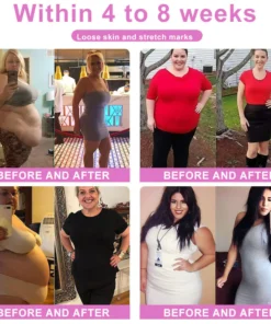 KaaLa™ Ceramic Ice Ionic Fiber Repair Shaping Pants